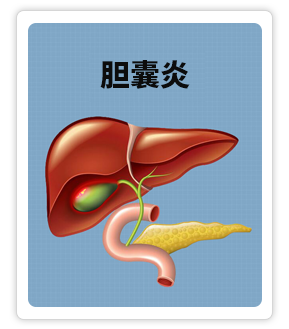 胆囊炎.png